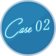 case 02