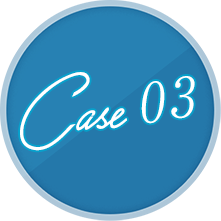 case 03