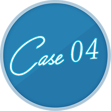 case 04